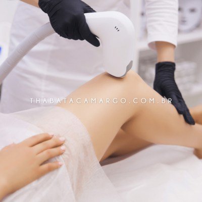 depilacao-laser-perna-inteira